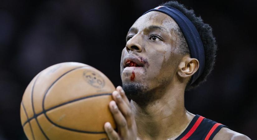 Kivérték a fogát egy kosarasnak, ömlött a vér az NBA-meccsen