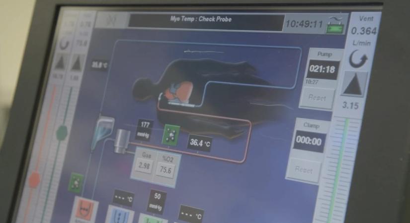 Tüdő nélkül élt egy férfi két napig