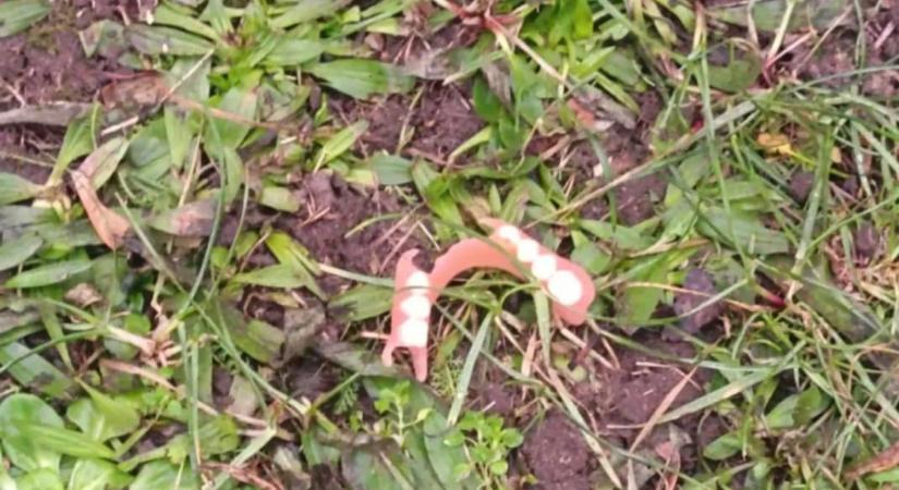 Rejtélyes műfogsorok Győrben – mi folyik a város zöldjében?