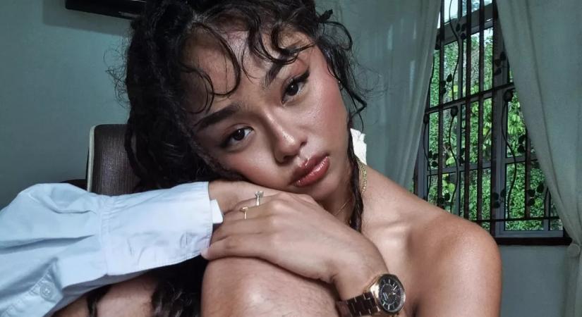 Extrém testszőrzete miatt ostorozzák ezt a 27 éves lányt