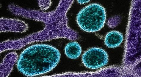 Ritka, de veszélyes: mit kell tudni a Nipah-vírusról a friss indiai esetek után