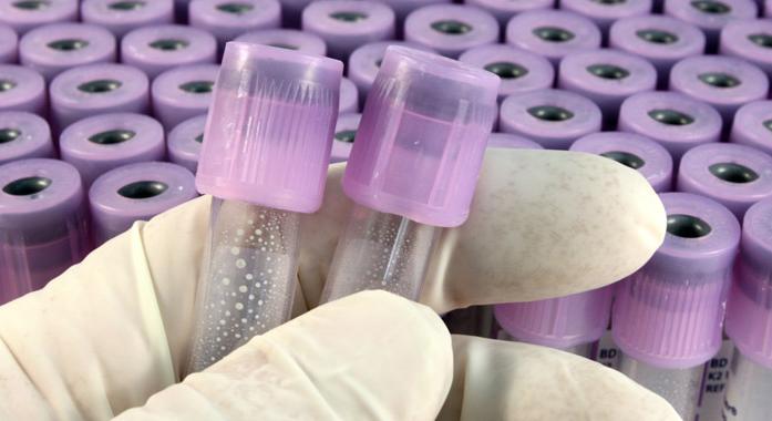 Antitrombin III (ATIII)