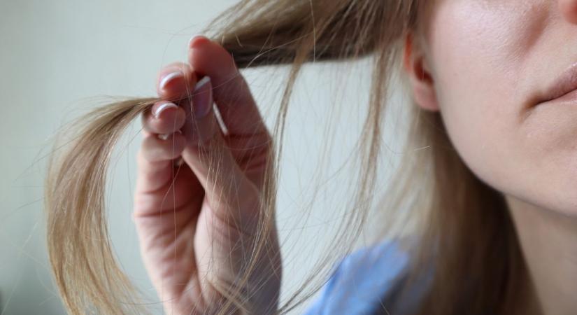 Hullik, töredezik, elvékonyodik – ezért szenved a hajad télen, de van sok jó tippünk is