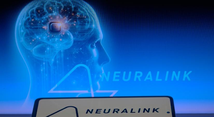 Csodát tett Elon Musk agychipje