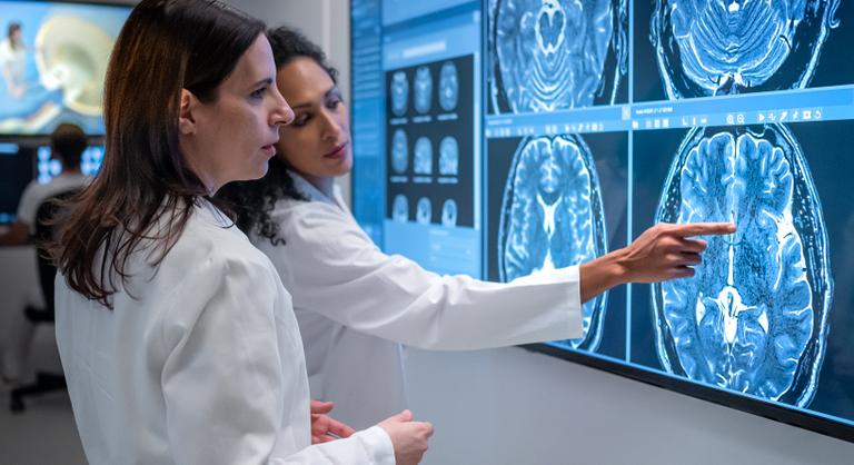 A menopauza összefügghet az Alzheimer-kórral, a nők ezért lehetnek veszélyeztetettebbek