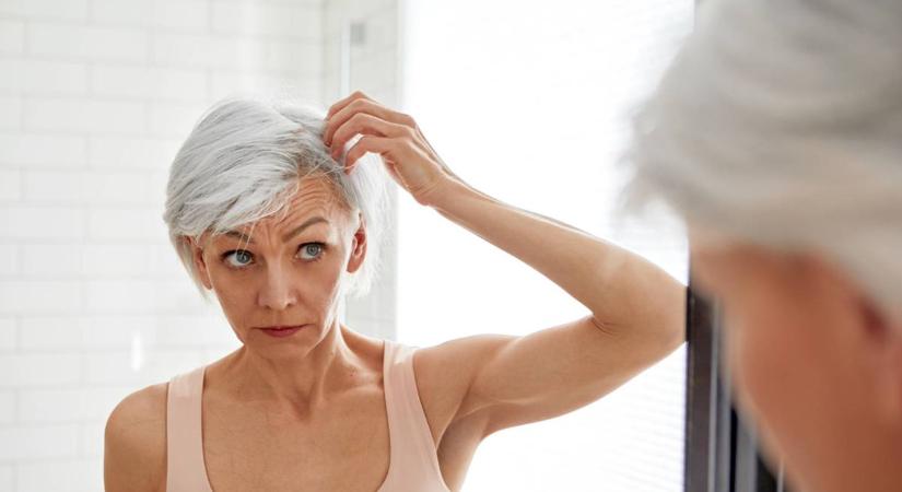 6 hajtünet, ami komoly egészségügyi problémára utal – Betegségekről árulkodnak