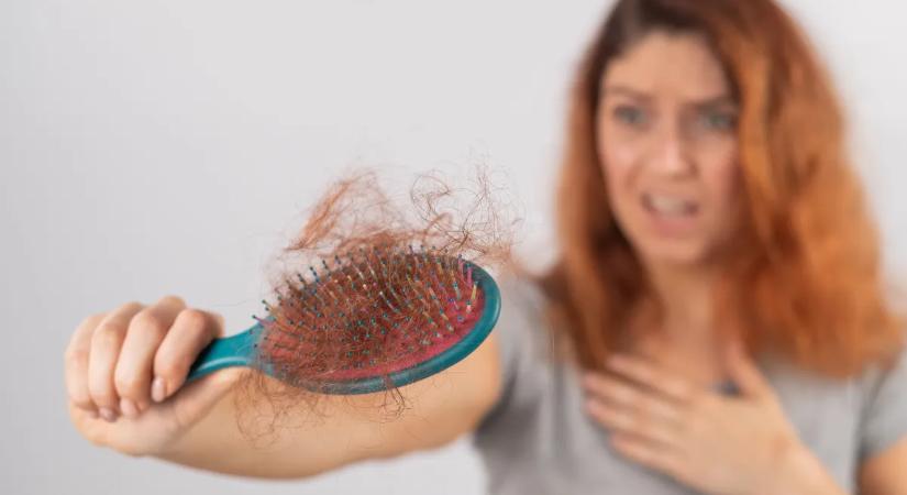 Hajhullás nőknél: ezen a ponton még visszafordítható a folyamat