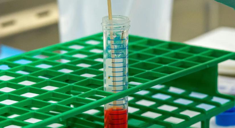 Egy egyszerű vérteszt mentheti meg az életét – komoly betegség előzhető meg