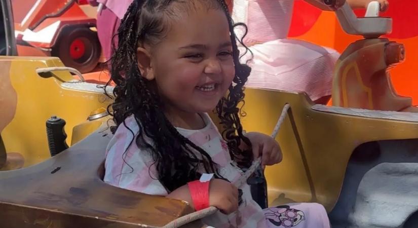 Az orvosok csak legyintettek a kiütésekre, most gyilkos kórral küzd a kétéves kislány