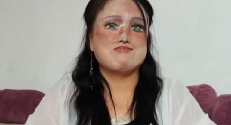 Minden nap újrarajzolja az arcát egy savtámadást túlélő nő