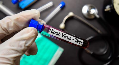 Az NNGYK folyamatosan nyomon követi a Nipah vírussal kapcsolatos nemzetközi helyzetet