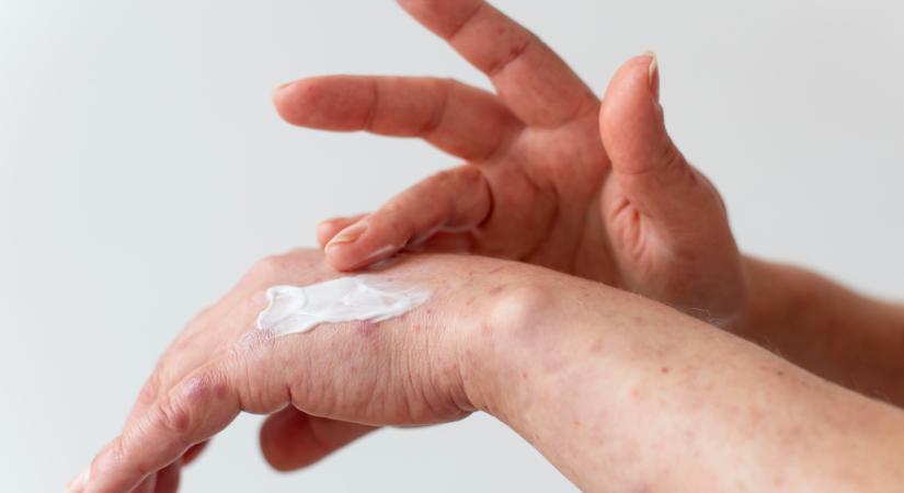 Rühjárvány van az egyik óvodában