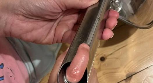 Baleset a konyhában: serpenyő fogantyújába szorult egy kisgyerek ujja