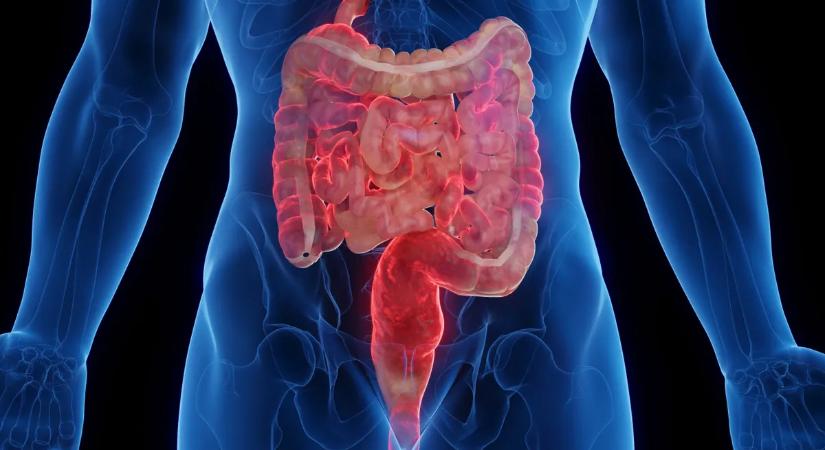 Rejtett veszély leselkedik a bélbetegekre – a csontvelőből indul a baj