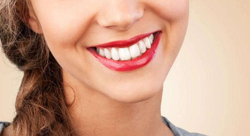 A hollywoodi mosoly nem álom többé: ezt próbáld ki, ha te is mindig rejtegeted a mosolyod