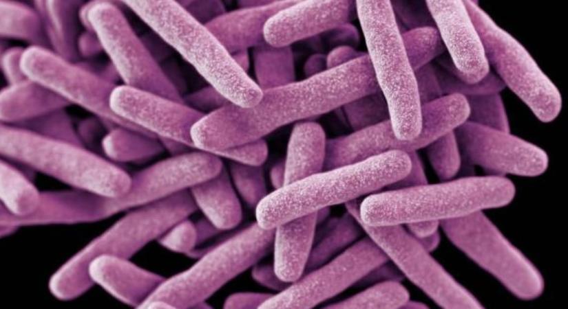 TBC-fertőzést igazoltak egy hódmezővásárhelyi általános iskolai dolgozónál – szűrővizsgálat indul