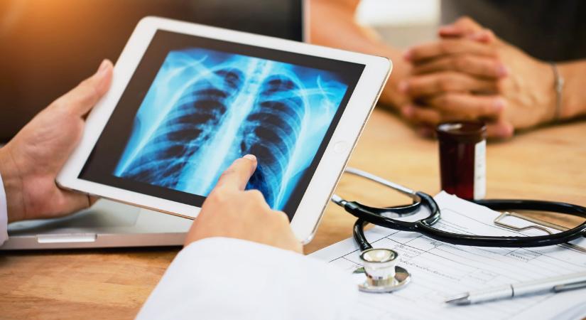 Tbc-megbetegedést igazoltak a hódmezővásárhelyi Szent István Általános Iskola egyik dolgozójánál