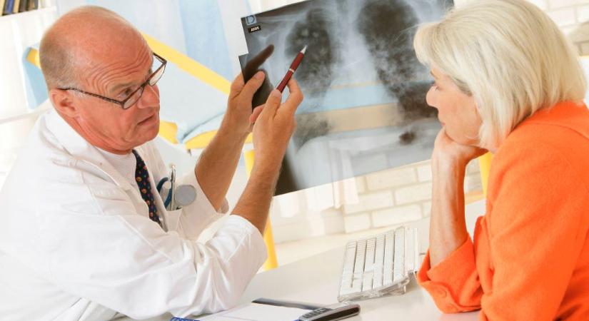 TBC-s lett egy hódmezővásárhelyi tanár, 250 kontaktot vizsgálnak