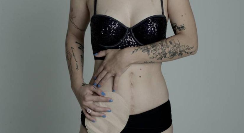 Ha a vidéki kórház intenzív osztályán marad, talán már nem élne: ma a divatszakmában dolgozik