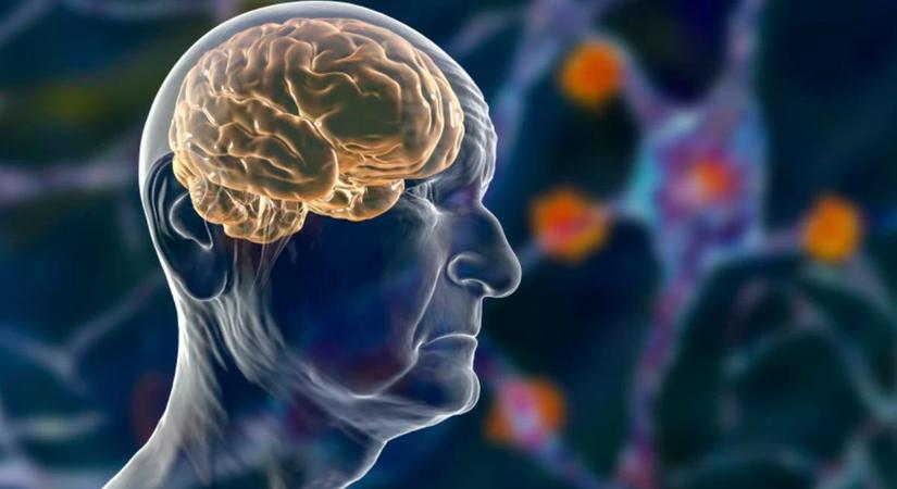 7 természetes módszer, ami akár 10 percen belül enyhíti a fejfájást