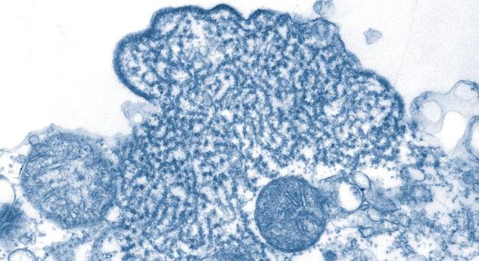 Nipah-vírus – Eldördülhet-e valaha a startpisztoly?