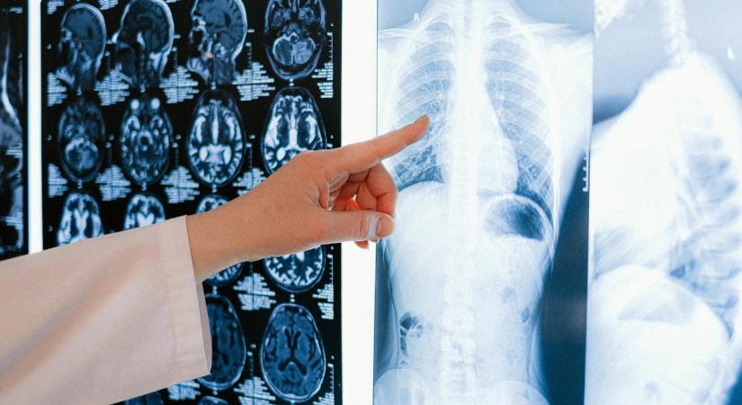 Rákellenes Világnap – Van három plusz egy szűrővizsgálat, amire egyszerűen nem mennek az emberek, pedig kéne