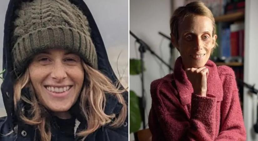 "Mintha gyorsított felvételen öregedett volna" – leleplezte a gyászoló férj, milyen valójában a rák elleni küzdelem