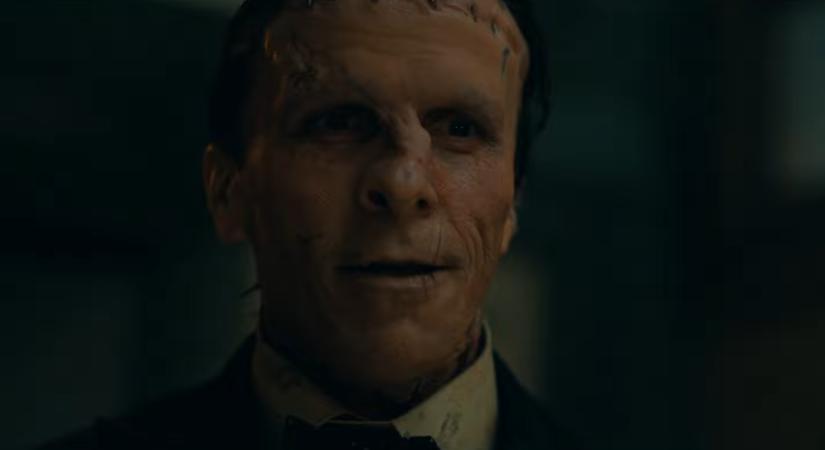 Christian Bale artikulátlanul üvöltözött, hogy ne őrüljön meg, miután minden nap 6 órát kellett ülnie a sminkszékben A menyasszony!-ban viselt maszkja miatt