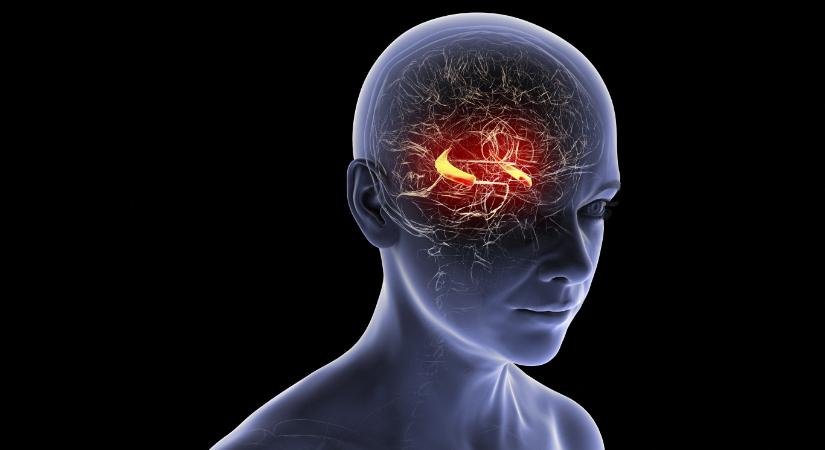 Nemcsak az agyat érintő betegségek okozhatnak demenciát, hanem más szervi elváltozások is