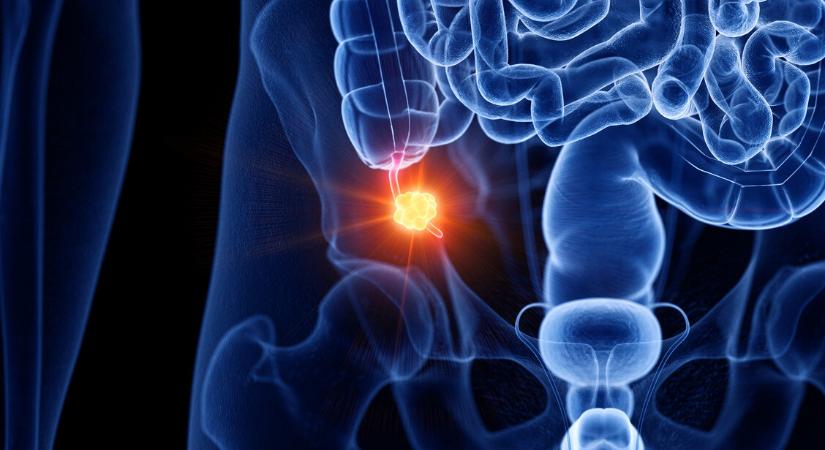 Felesleges szervnek tartják, pedig nagyon is hasznos – Mi a féregnyúlvány szerepe?