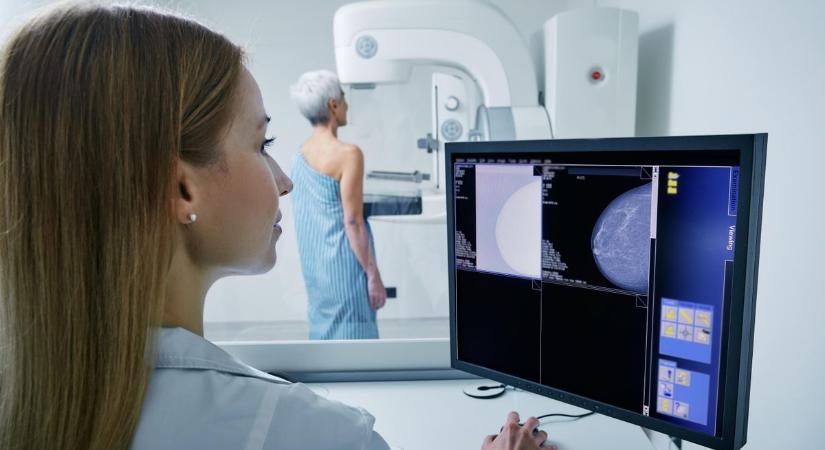 „Ez a kemoterápia értem van, gyógyít engem” – Harmadik stádiumú emlődaganat volt a diagnózis