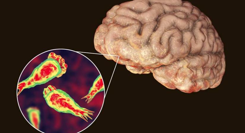 Az agyevő amőba Magyarországon is jelen lehet: figyelmeztetnek a szakemberek