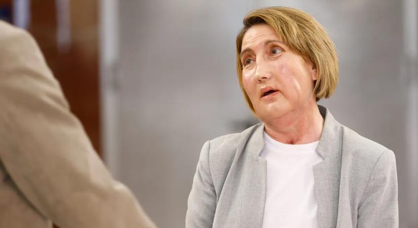 Húsevő baktérium marcangolta szét egy nő arcát: sci-fibe illő arcátültetéssel mentették meg