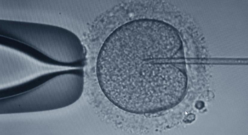 Kiderült, milyen sikerességi rátával dolgoznak a magyarországi lombikklinikák