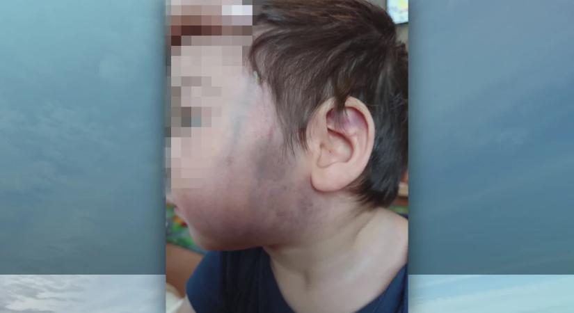 Molesztálás miatt nyomoznak