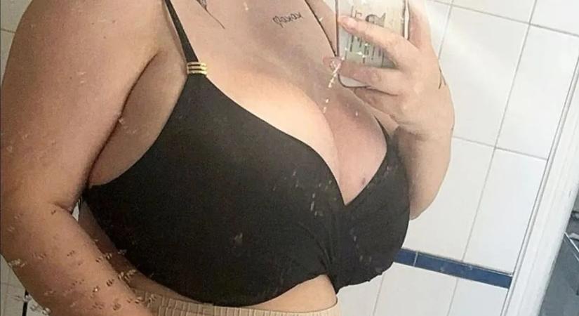 Nagy mellek miatt került kórházba – 32 kiló tépte fel a bőrét