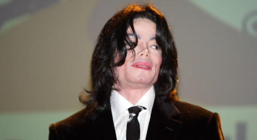 Sokkoló részletek láttak napvilágot Michael Jackson boncolási jegyzőkönyvéből: rohadó bőr, teljes kopaszság