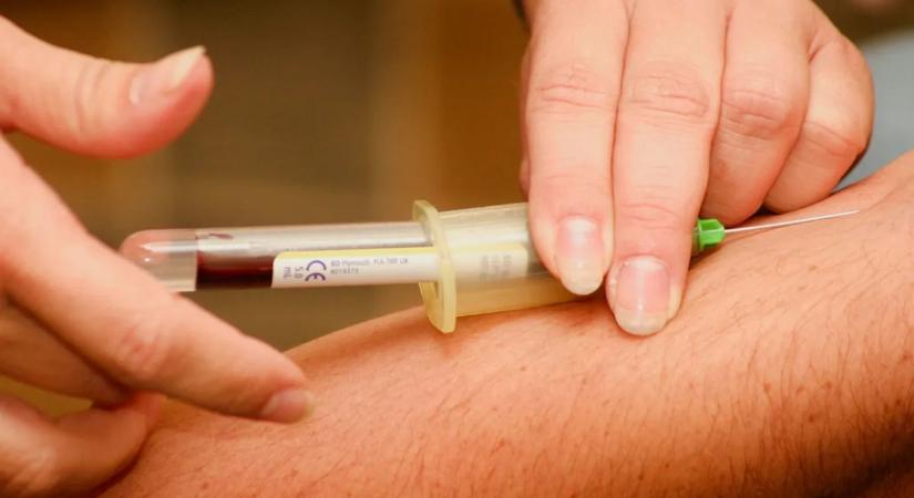 Tiltólista: Ezek az élelmiszerek csendben emelik a koleszterinszintet