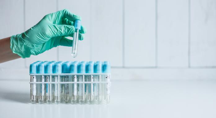 Az APC-rezisztencia (aktivált protein C rezisztencia)