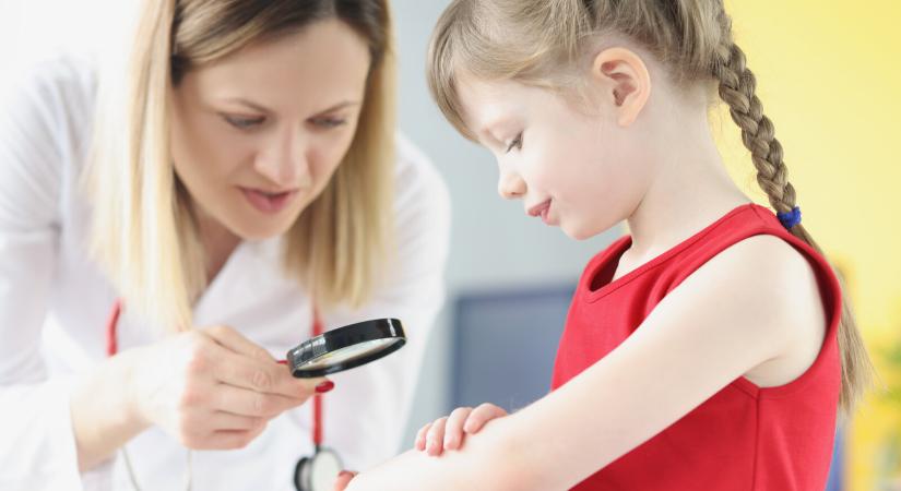 Anyajegyszűrés: mikortól kell vinni a gyereket? – Ezek lehetnek a figyelmeztető tünetek