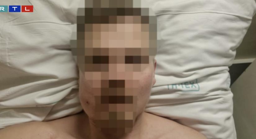 Nem kell túlragozni – mondta az egészségügyi államtitkár a szenteste politikai okokból megütött, majd a veszprémi kórházból nyílt állkapocstöréssel hazaengedett férfi esetéről