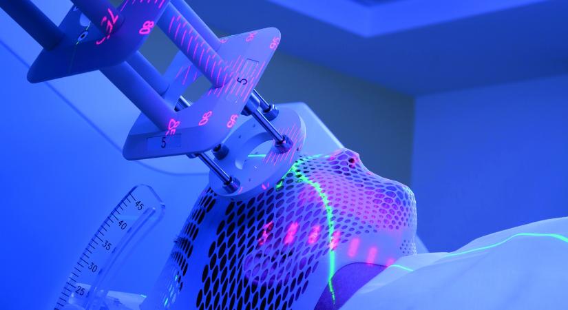 Új megközelítés emlőrák agyi áttétképződésének megakadályozására