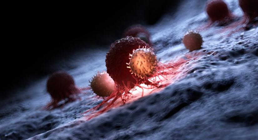 Ezért lehetnek láthatatlanok bizonyos daganatok