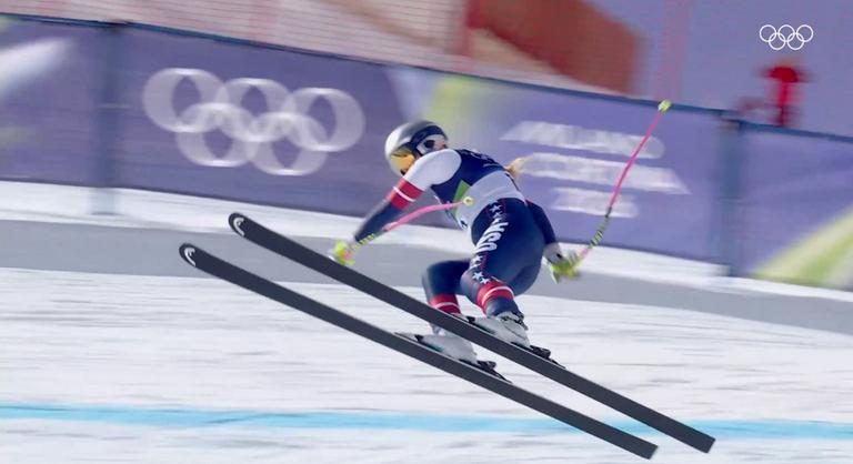 Újabb részletek derültek ki Lindsey Vonnról, horrorisztikus bukása után nem volt elég egyszer megműteni