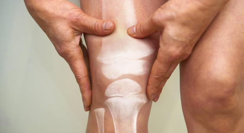 Segíthet a csontritkulás megelőzésében, ha ezt mindennap csinálod