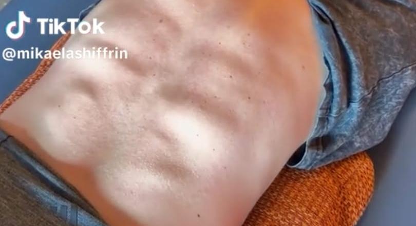 „Nem tudtam, hogy így néz ki a hátam” – videón mutatta meg az amerikaiak olimpiai bajnok sztársíelője kockás hátát