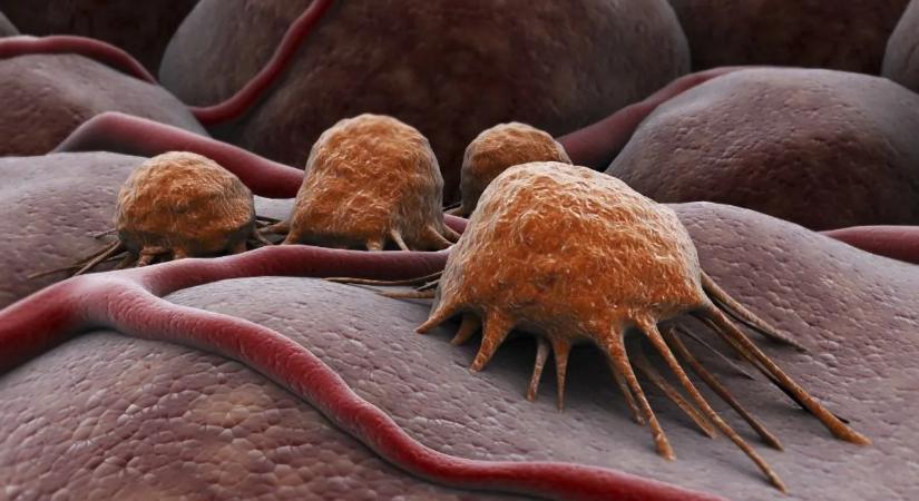 Magyar kutatók találmánya győzheti le a rákot