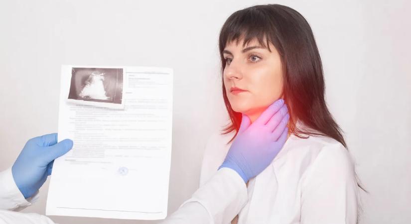 Sokáig nem vették komolyan a furcsa tünetet – a 40 éves nő végül elveszítette a teljes pajzsmirigyét