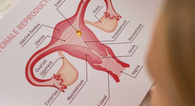 Aggasztó romániai méhnyakrák-statisztika: naponta kilenc új eset és hat haláleset