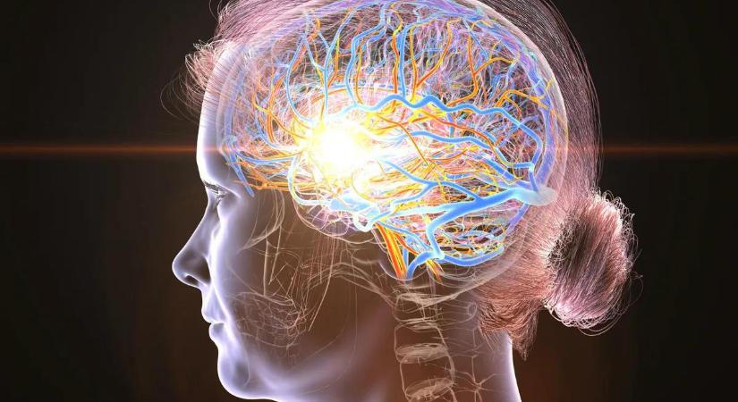 Hölgyek, figyelem! Ez a stroke megakadályozásának kulcsa